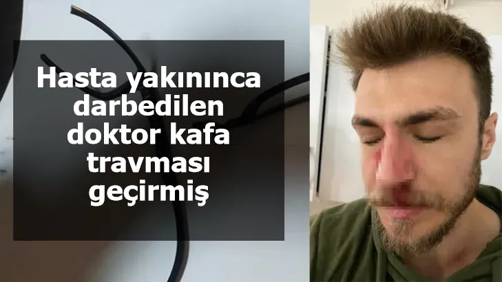 Hasta yakınınca darbedilen doktor kafa travması geçirmiş